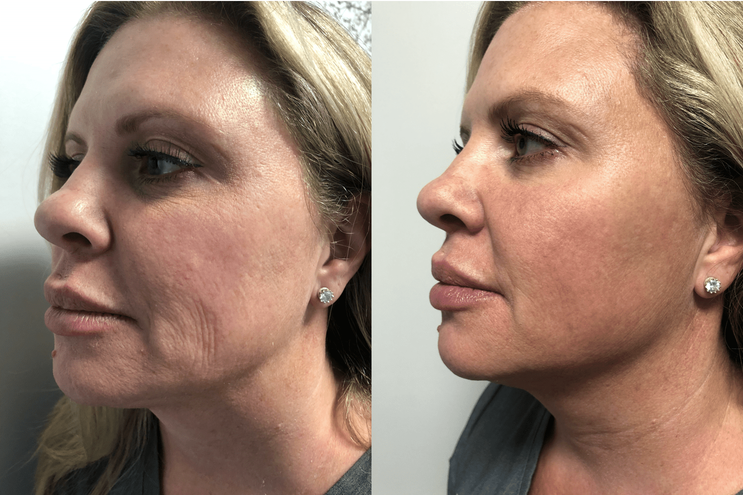 Grand Salon & Medspa in Denver offering professional salon and medspa services