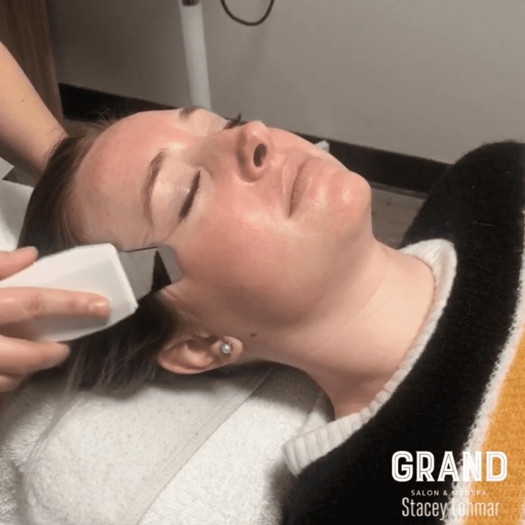 exfoliation dermaplane Grand Salon & MedSpa