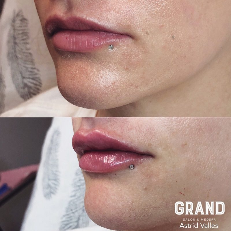 Grand Salon & Medspa in Denver offering professional salon and medspa services